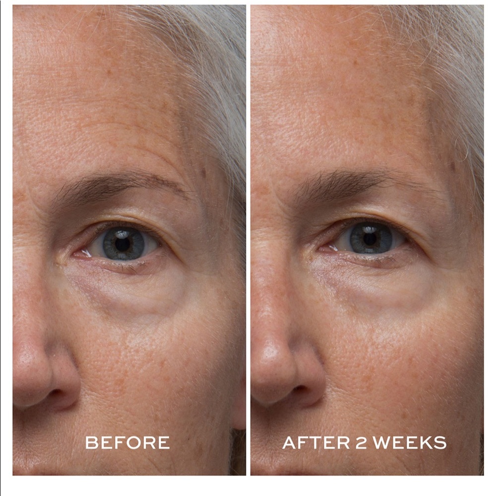 Elemis - Picture 5 of 5